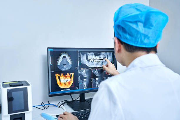 Best Emergency Tooth Extraction in Doctor Phillips, FL
